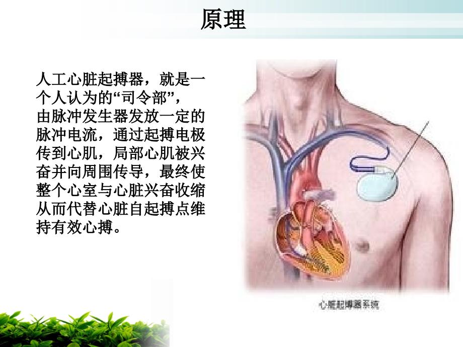 永久起搏器植入病人护理及相关注意事项_第3页