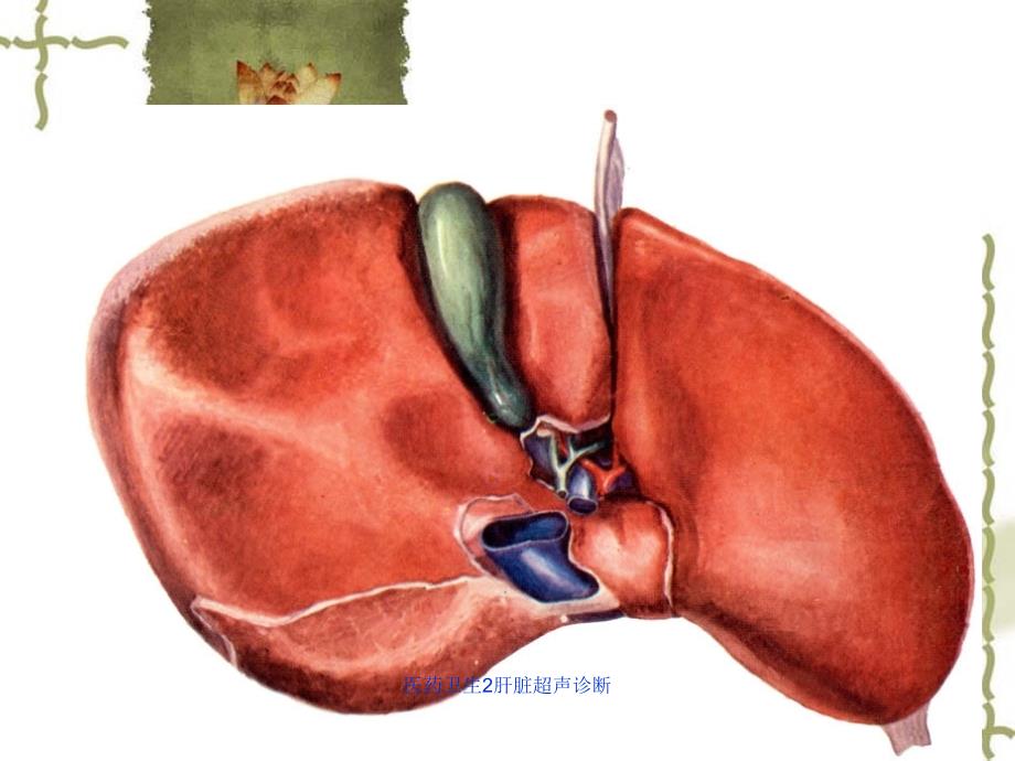 医药卫生2肝脏超声诊断课件_第3页