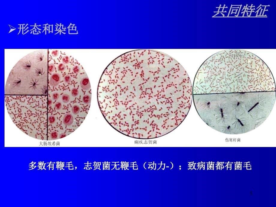 微生物埃希菌志贺菌ppt课件_第5页