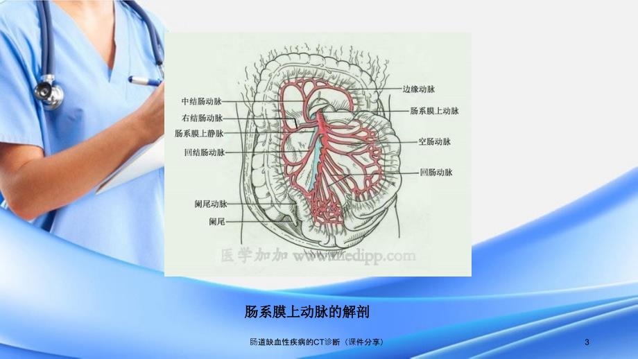 肠道缺血性疾病的CT诊断课件分享_第3页