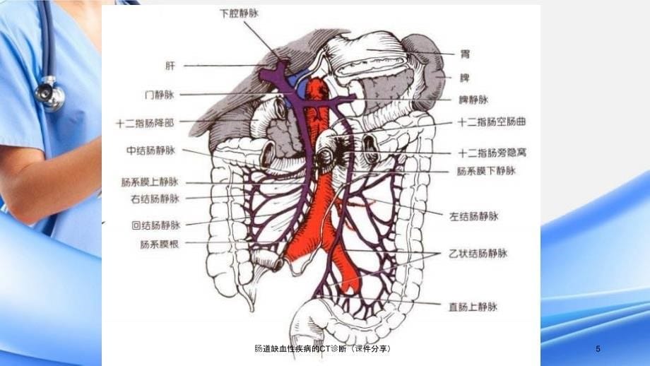 肠道缺血性疾病的CT诊断课件分享_第5页