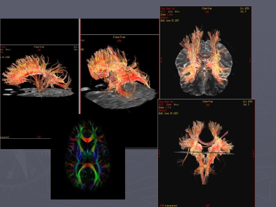 DTI的基本原理及其在中枢神经系统中的应用文档资料_第2页