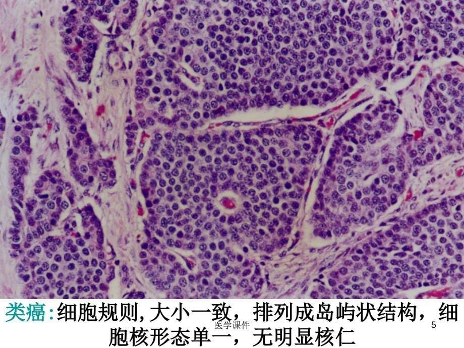 组织病理学--诊断消化-PPT课件_第5页