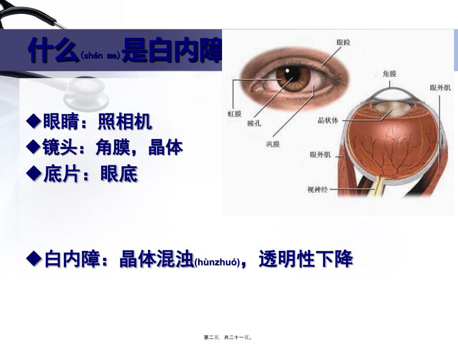 白内障的科普介绍课件_第2页