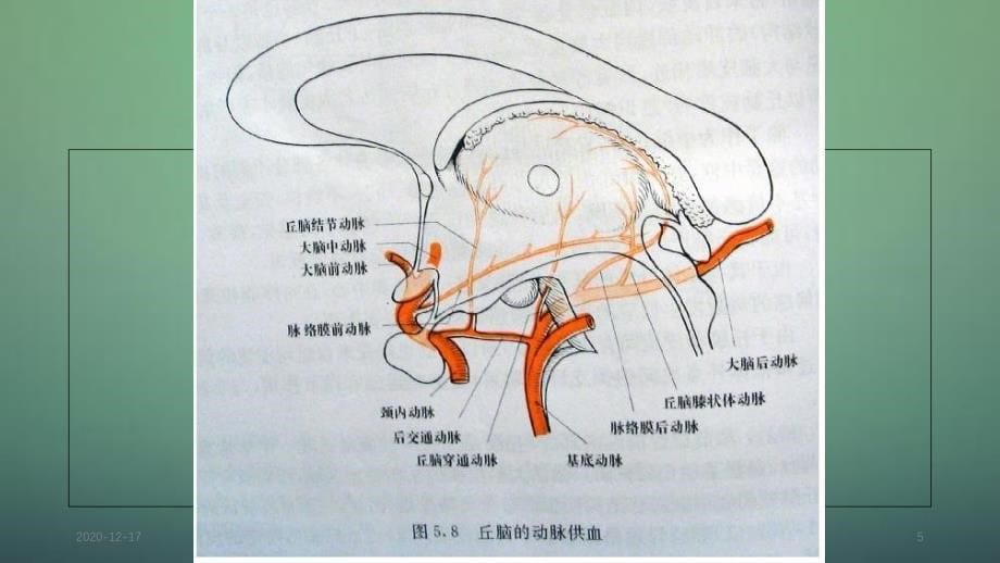 丘脑供血动脉及丘脑梗死4_第5页