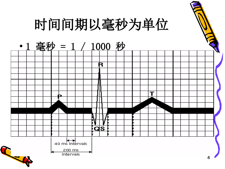 心脏起搏器心电图ppt参考课件_第4页