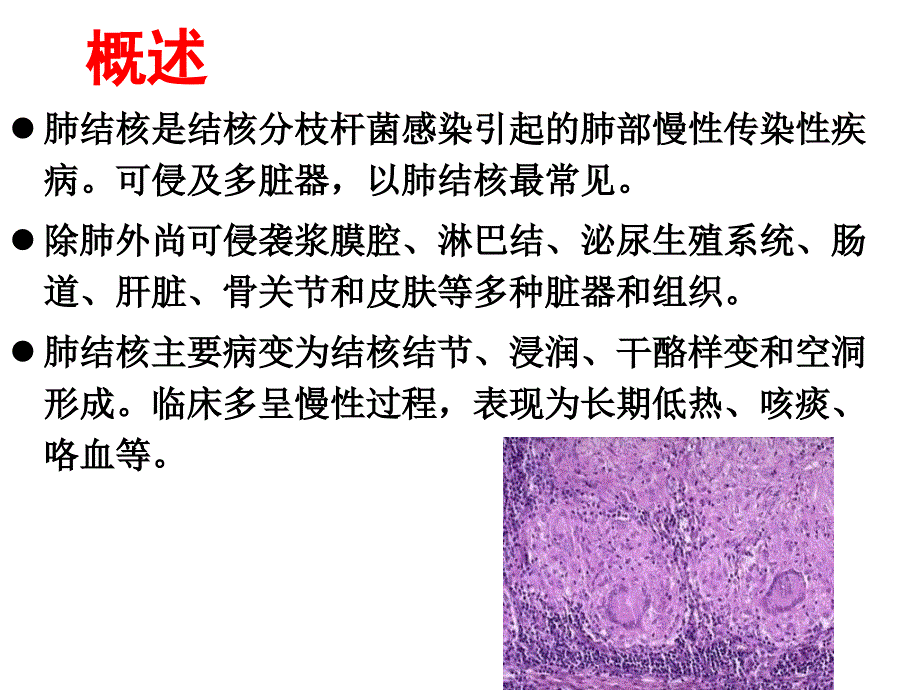 肺结核本科内科护理临床部分_第2页