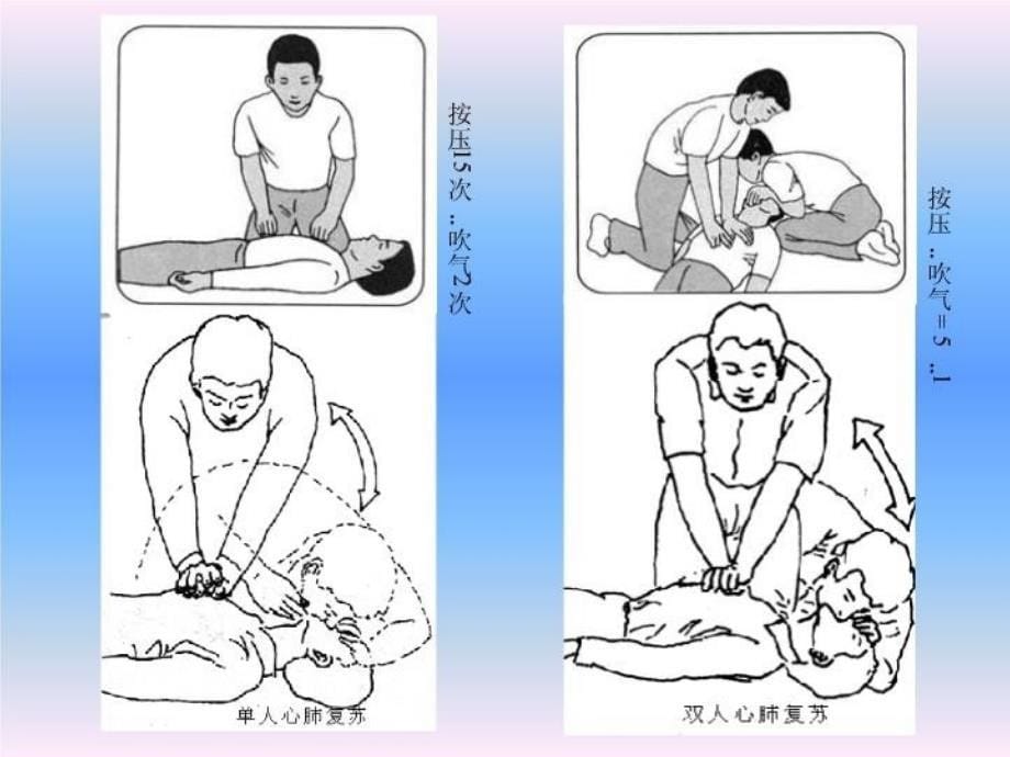 最新医学常识现场急救ppt课件_第5页