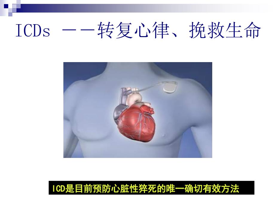 ICD术后未曾治疗者仍需要更换_第3页