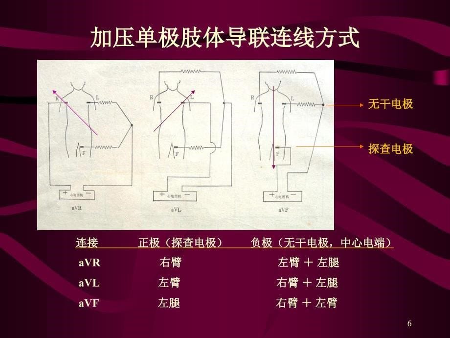 心电图心电向量与心肌缺血_第5页