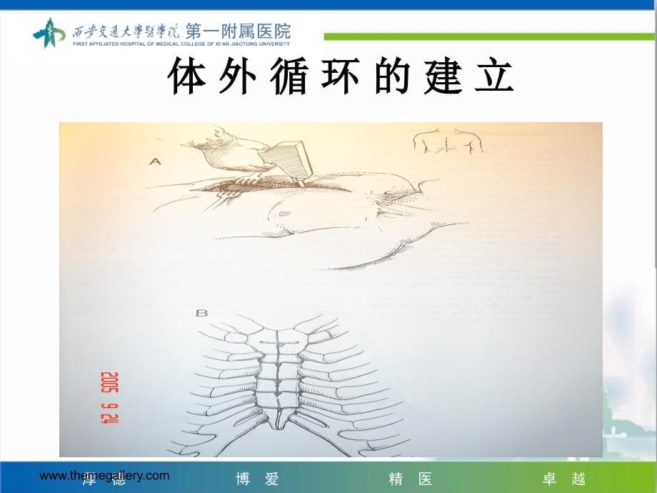 外科学教学课件：体外循环_第5页