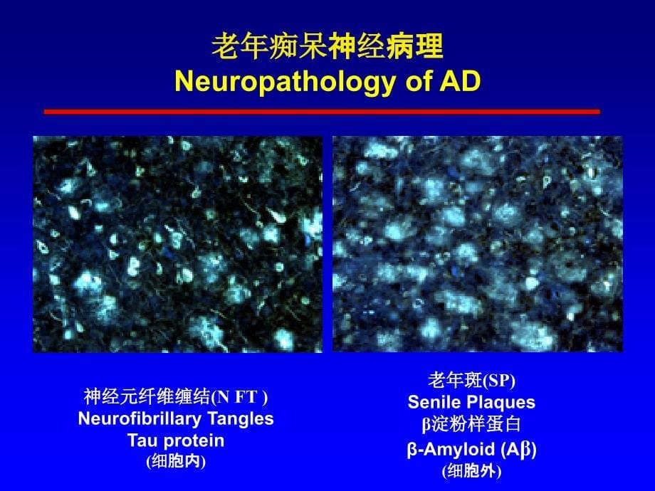 老年痴呆实验动物模型研制进展_第5页