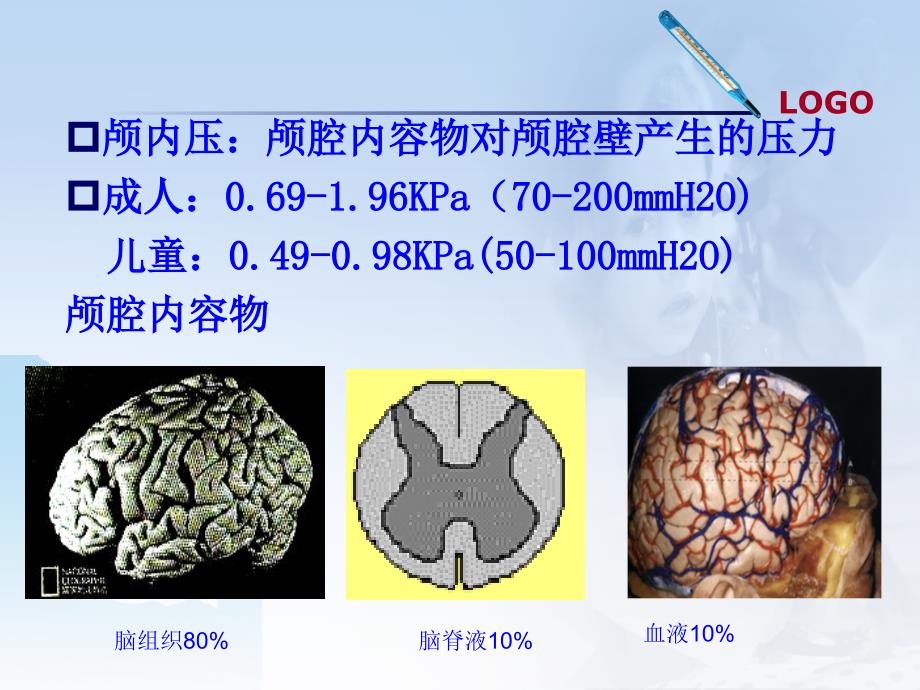 二值培训颅内高压的护理_第3页