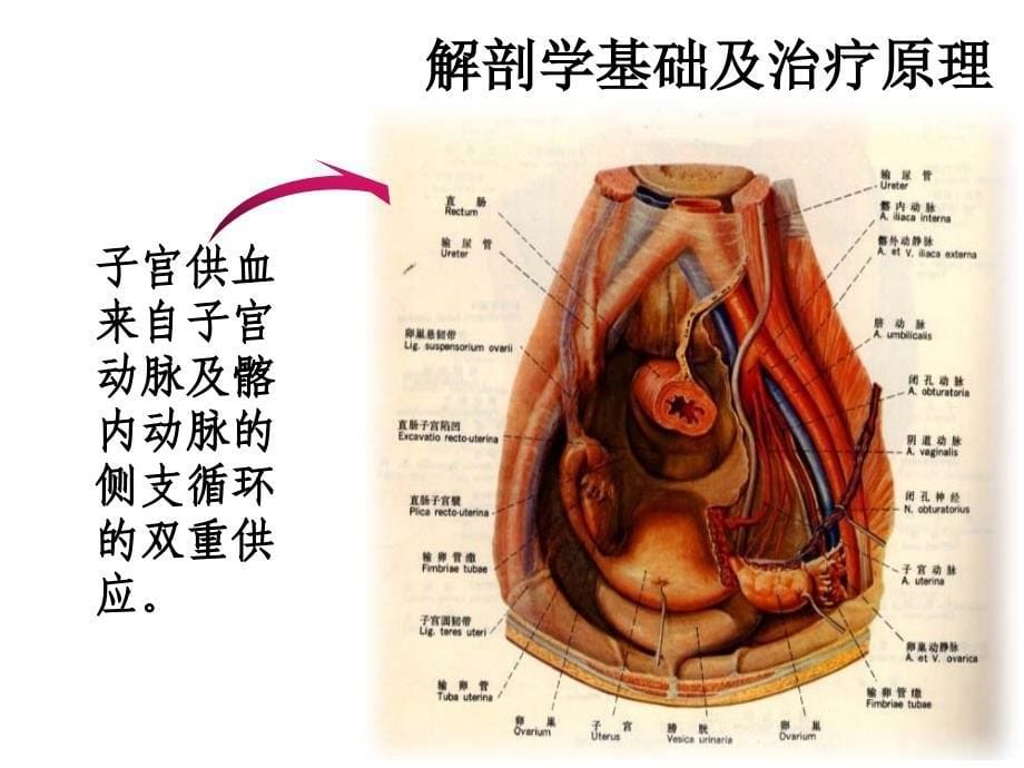 子宫动脉栓塞术的护理2021优秀课件_第5页