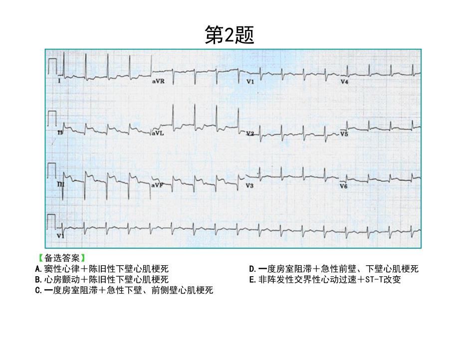 最新心电图考核题ppt课件PPT课件_第2页