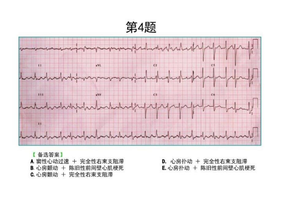 最新心电图考核题ppt课件PPT课件_第4页