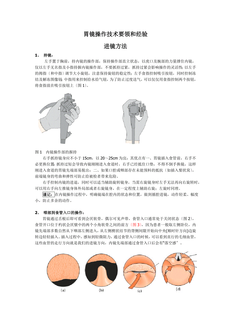 胃镜操作技术要领和经验(重点)_第1页