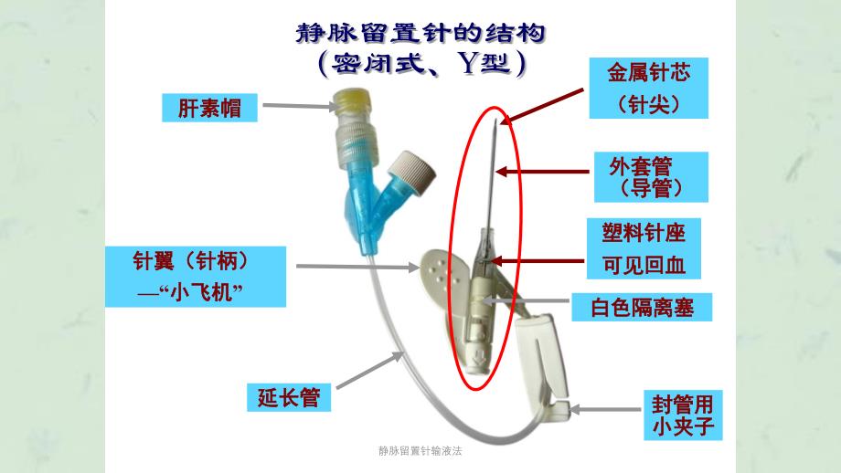 静脉留置针输液法课件_第4页