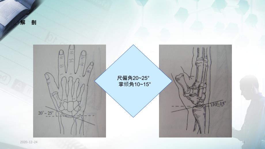 桡骨远端骨折的护理查房实用课件_第4页