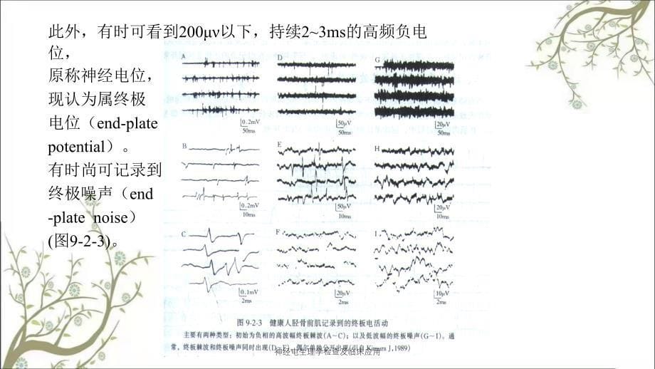 神经电生理学检查及临床应用_第5页