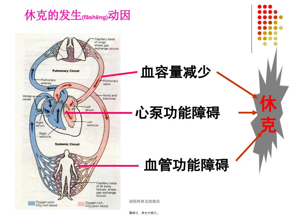 创伤性休克的救治课件_第4页