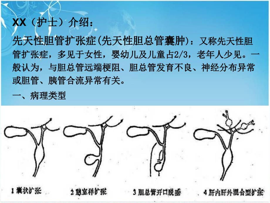 先天性胆总管囊肿护理查房课件_第3页