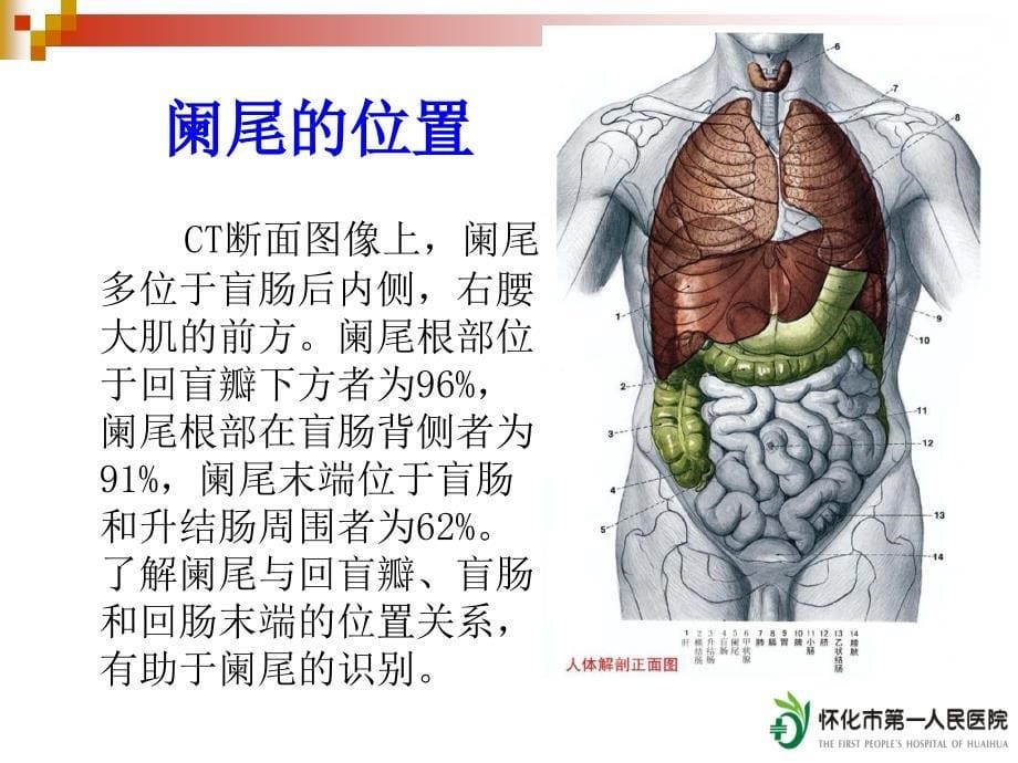 急性阑尾炎的CT诊断 PPT课件.ppt_第5页