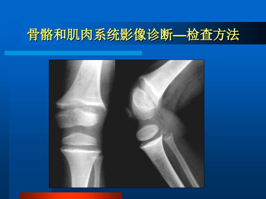 医学影像学课件：骨骼和肌肉系统影像诊断_第4页