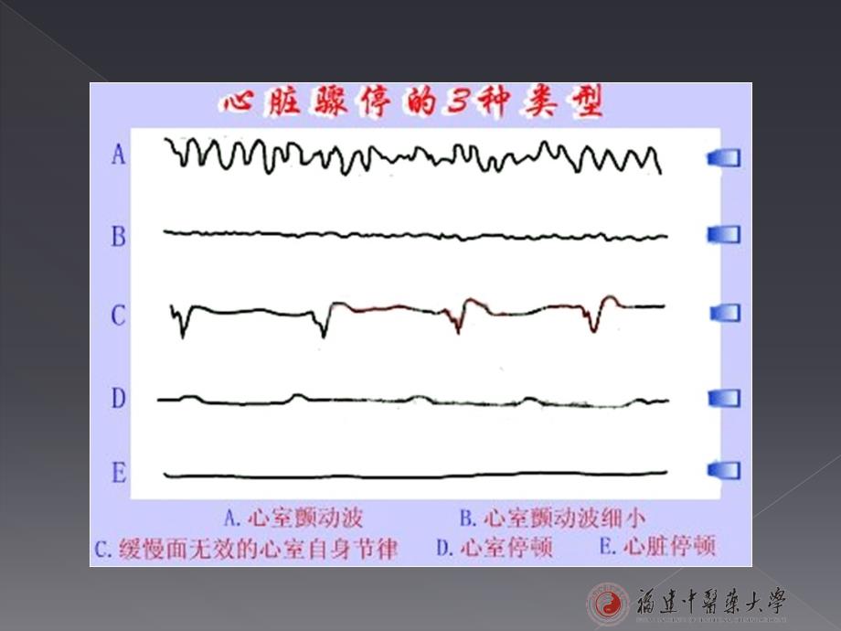 临床技能训练：心脏电复律_第4页