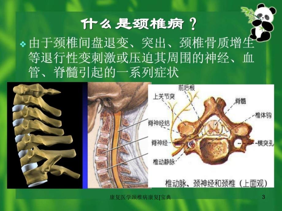 康复医学颈椎病康复宝典课件_第3页