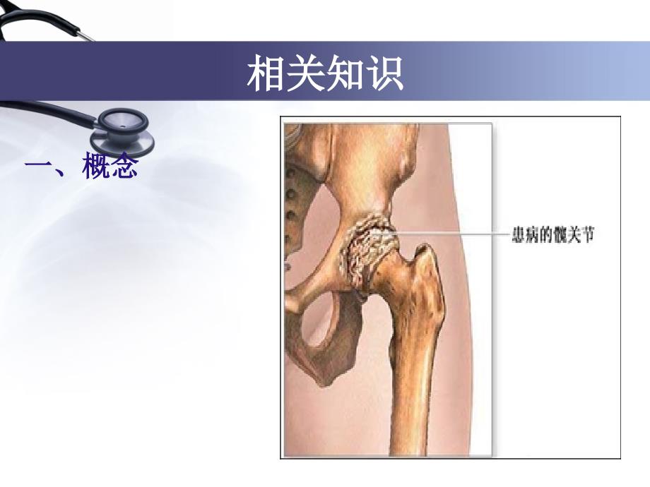 人工全髋关节置换术教案资料_第3页