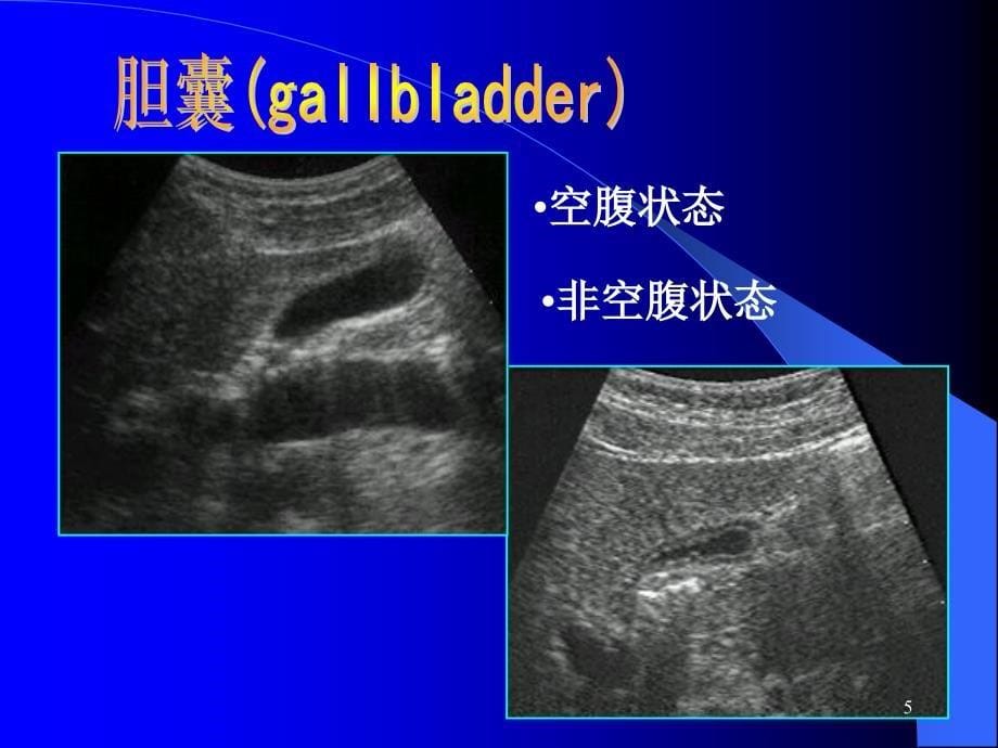 胆系超声检查PPT课件_第5页