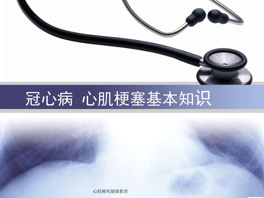 心肌梗死健康教育课件_第2页