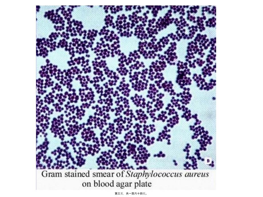 医学专题—第八章常见致病细菌3907_第3页