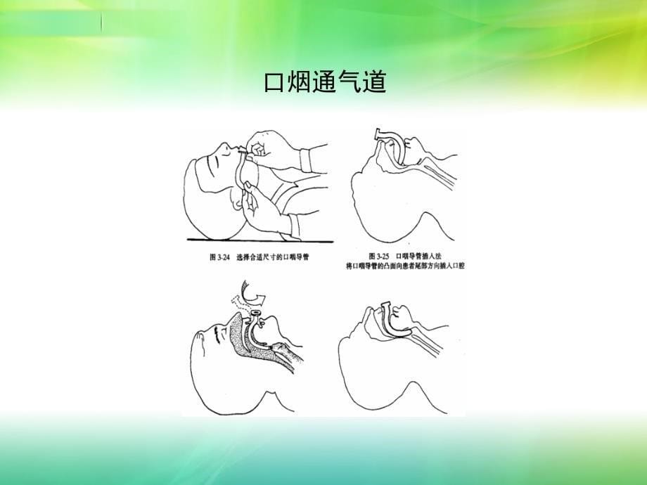 急诊专科护士培训ppt课件_第5页