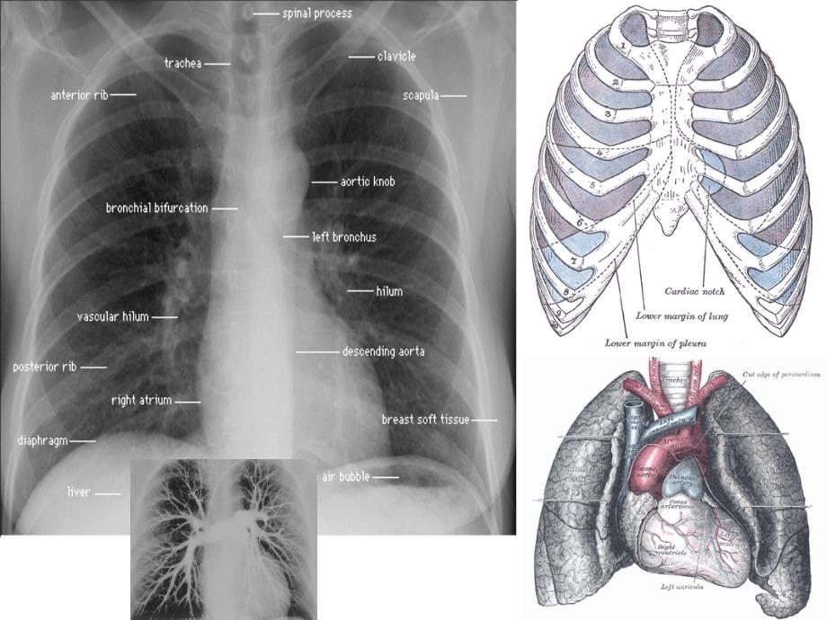 《胸部影像阅读基础》PPT课件讲课教案_第4页