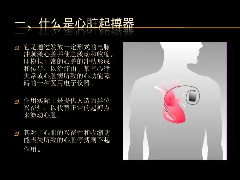 三腔起搏器治疗心衰的护理课件_第2页