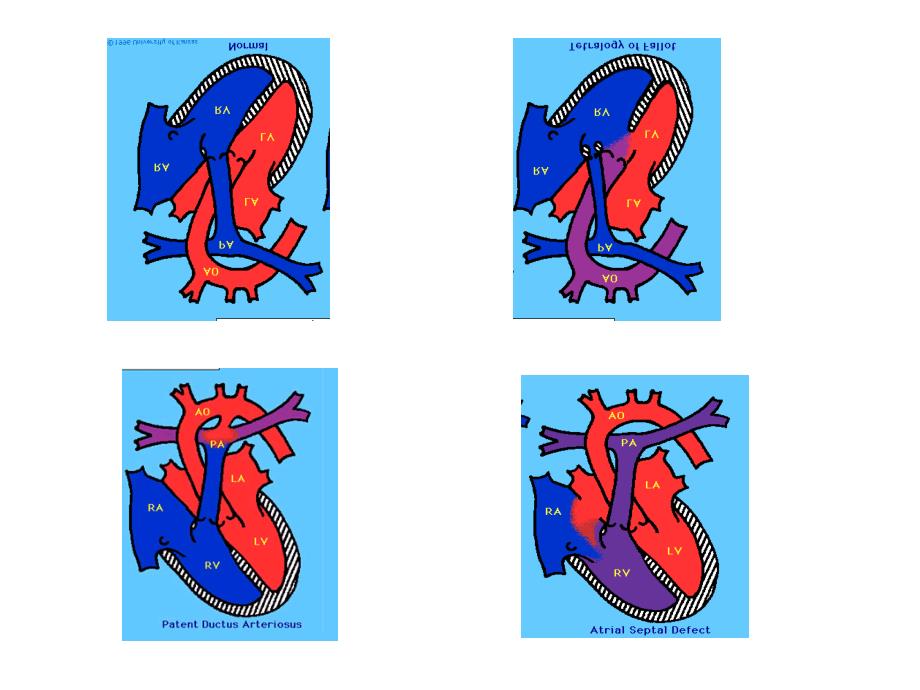 先天性心脏病学时.ppt_第2页