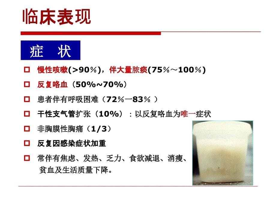 支气管扩张兰瑛_第5页