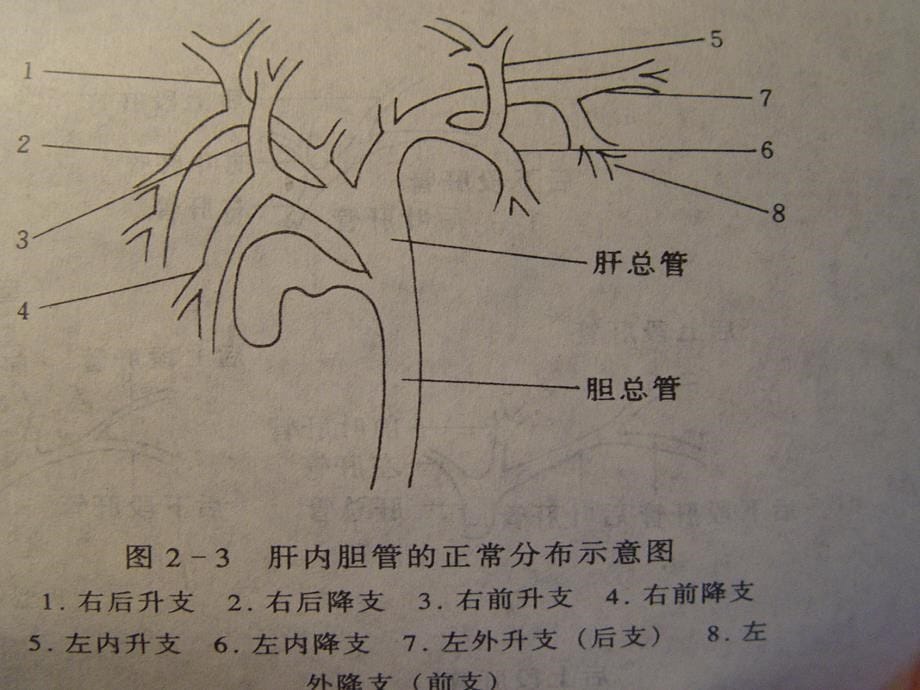 胆石症病人的护理_第5页