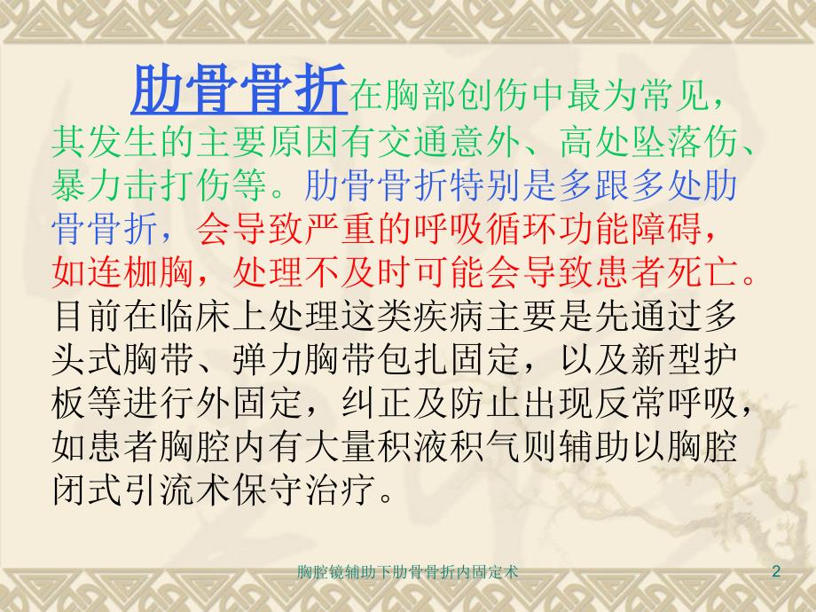 胸腔镜辅助下肋骨骨折内固定术课件_第2页