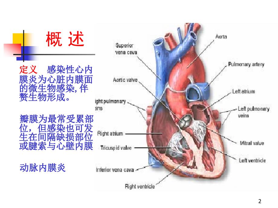 感染性心内膜炎2学时ppt课件_第2页