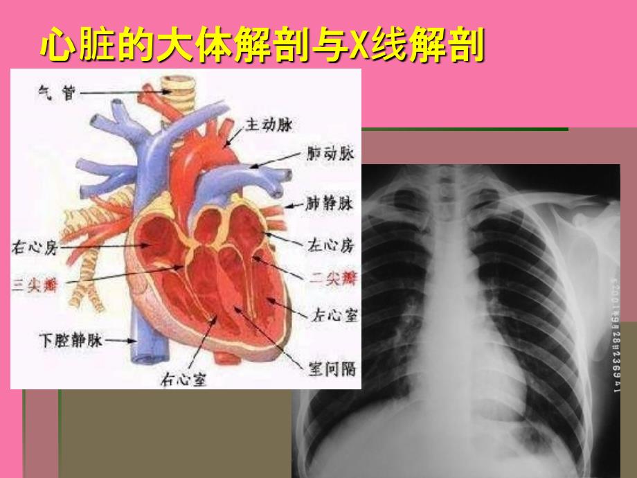 扩展阅读纵隔心血管的解剖ppt课件_第4页