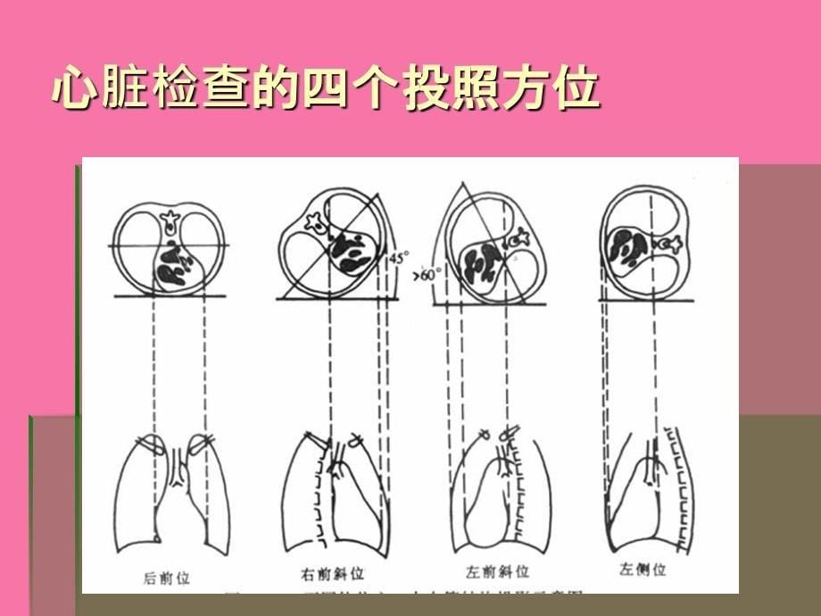 扩展阅读纵隔心血管的解剖ppt课件_第5页