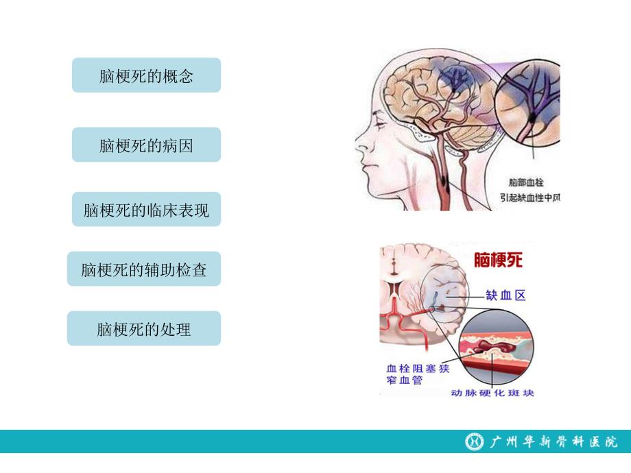 脑梗死的处理流程_第3页