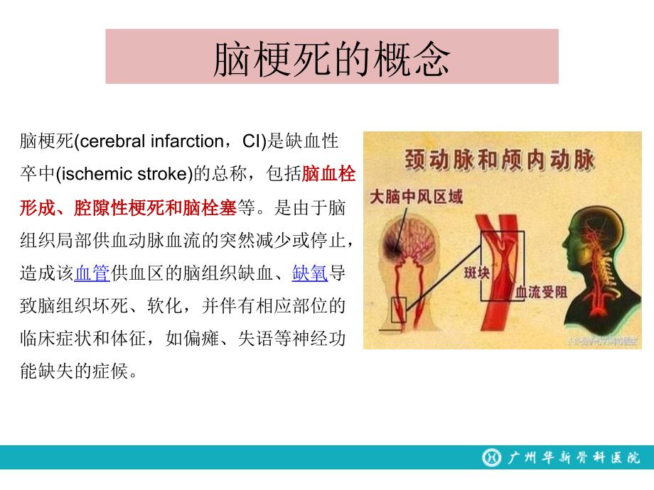 脑梗死的处理流程_第4页