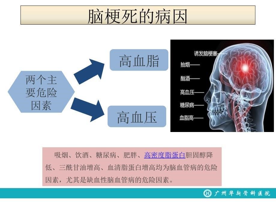 脑梗死的处理流程_第5页