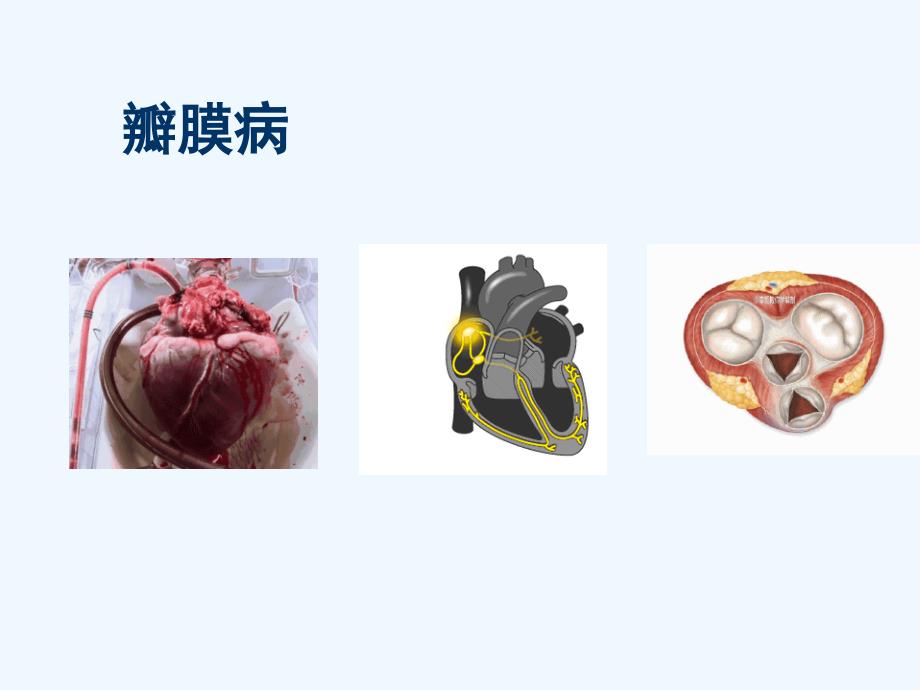 心外科常见疾病_第3页