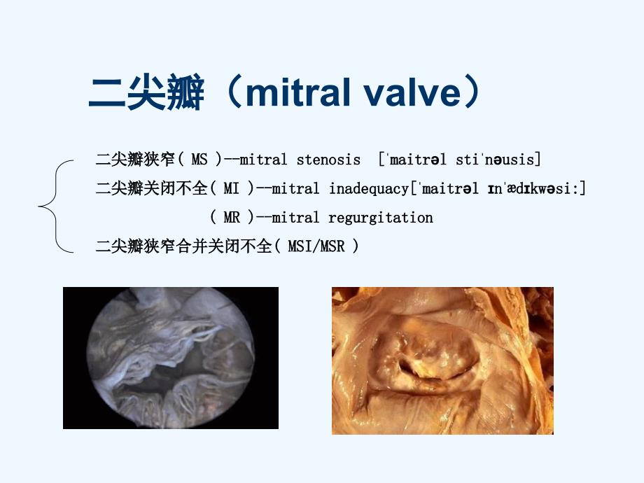 心外科常见疾病_第4页