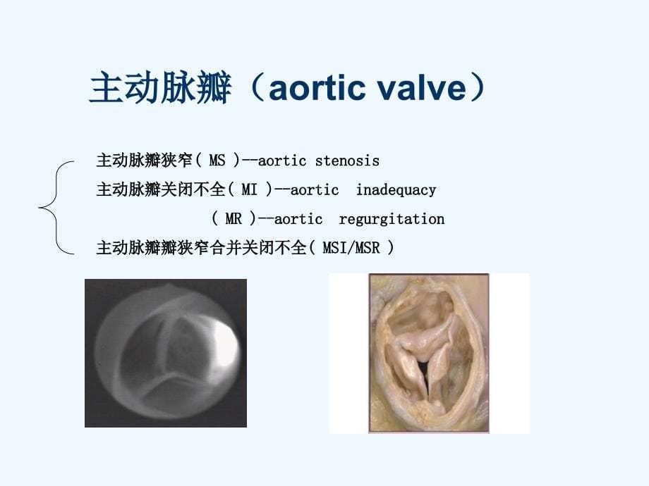 心外科常见疾病_第5页